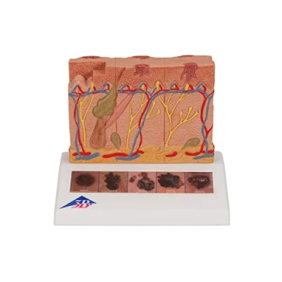 Obrázek 3B Scientific Lidská anatomie model rakoviny kůže + bezplatná aplikace pro Smart Anatomy, J15