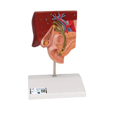 Obrázek 3B Scientific Lidská anatomie model žlučových kamenů + bezplatná aplikace Smart Anatomy