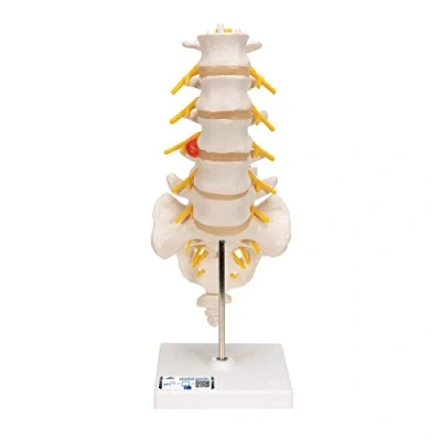 Obrázek 3B Scientific Lidská anatomie bederní páteř s dorsolaterální kýlou ploténky + bezplatná aplikace pro anatomii Smart Anatomy