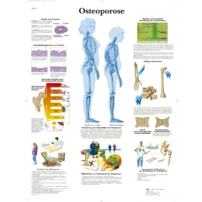Obrázek 3B Scientific kalibr tabule Laminované Osteoporose