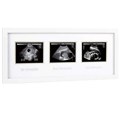 Obrázek Pearhead Pregnancy Trimester Sonogram Frame, Ultrasound Picture Milestone Keepsake Photo Keepsake, Gender Neutral Baby Nursery Décor, 1st 2nd and 3rd Trimester, White